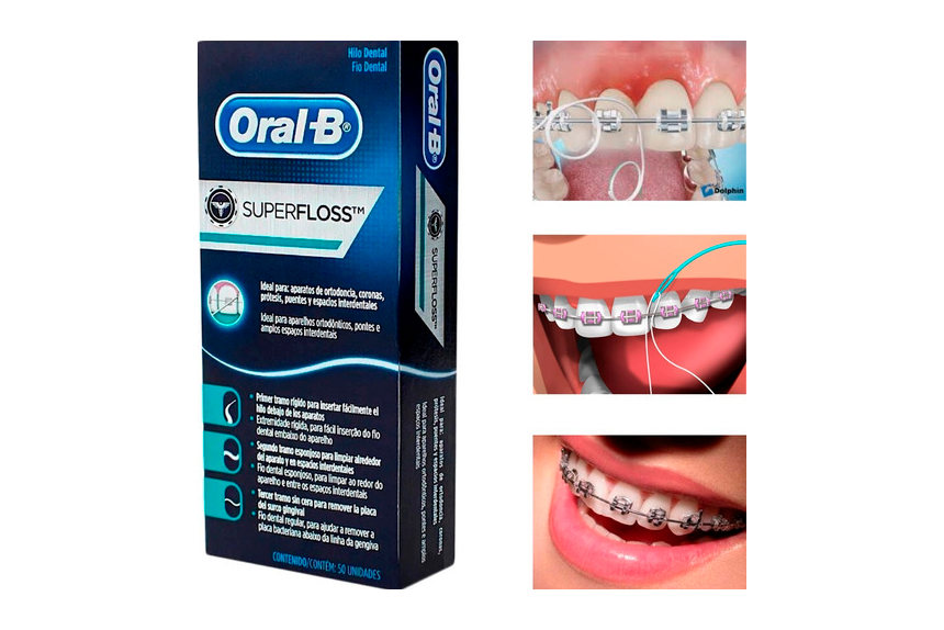 AU superflossl - Periodontia e orientações de higiene oral